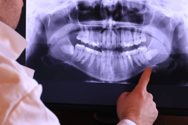 Best Emergency Dental Services for Seniors in Tontitown, AR
