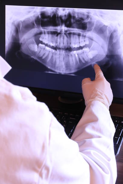 Best Emergency Dental Extractions in Tontitown, AR