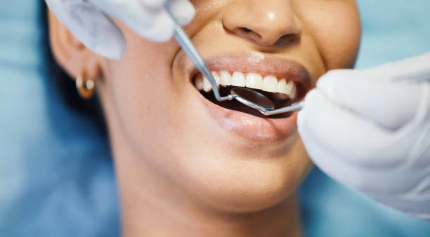 Best Emergency Dentist for Knocked-Out Tooth in Tontitown, AR
