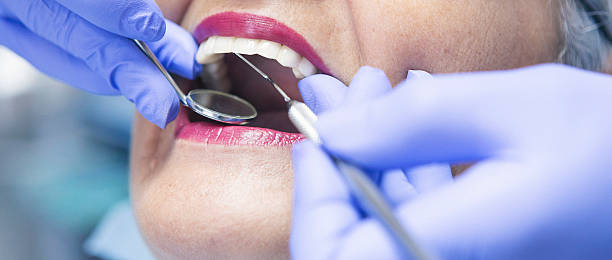 Best Emergency Dentist for Lost Fillings or Crowns in Tontitown, AR