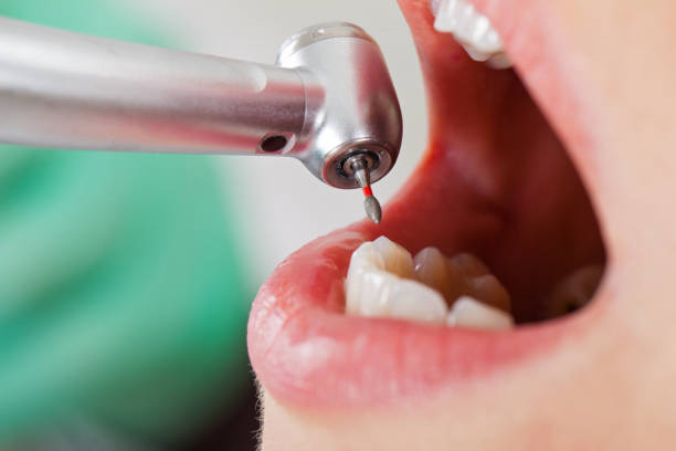 Best Orthodontic Emergency Dentist in Tontitown, AR